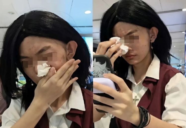 Wajah Berubah karena Oplas atau Diet? Ini Aturan Foto Paspor yang Wajib Kamu Tahu!